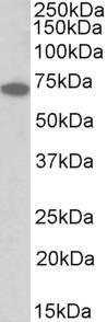 Anti-IFNGR1 Antibody (A85129) (03 µg/ml) staining of HepG2 lysate (35 µg protein in RIPA buffer) Primary incubation was 1 hour Detected by chemiluminescence