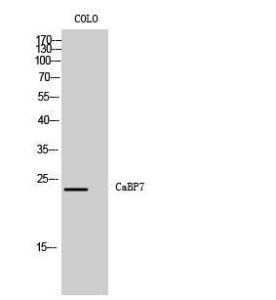 Western blot analysis of COLO cells using Anti-CABP7 Antibody