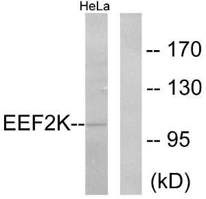 Western blot analysis of lysates from HeLa cells, treated with serum 10% 15' using Anti-eEF2K Antibody. The right hand lane represents a negative control, where the antibody is blocked by the immunising peptide