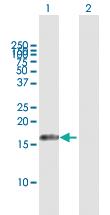 Anti-AIF1L Mouse Polyclonal Antibody