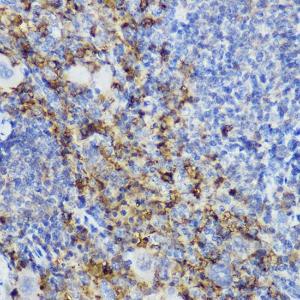 Immunohistochemistry analysis of paraffin-embedded mouse spleen using Anti-CTLA4 Antibody (A8994) at a dilution of 1:200 (40X lens). Perform high pressure antigen retrieval with 10 mM citrate buffer pH 6.0 before commencing with IHC staining protocol