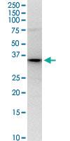 Anti-PNMA1 Rabbit Polyclonal Antibody