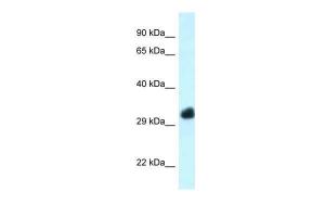 Anti-FBXO22 Rabbit Polyclonal Antibody