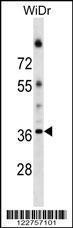 Anti-ALG5 Rabbit Polyclonal Antibody (APC (Allophycocyanin))