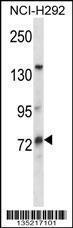 Anti-MUM1L1 Rabbit Polyclonal Antibody