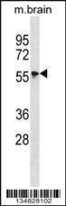 Anti-MAPK4 Rabbit Polyclonal Antibody