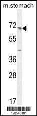 Anti-ESCO2 Rabbit Polyclonal Antibody