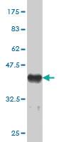 Anti-MED16 Mouse Monoclonal Antibody [clone: 3F5]