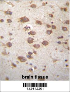 Anti-STAP2 Rabbit Polyclonal Antibody (FITC (Fluorescein Isothiocyanate))