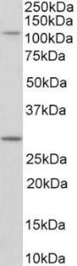 Anti-Myo1H antibody