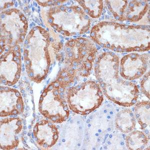 Immunohistochemistry analysis of paraffin-embedded rat kidney using Anti-CLPP Antibody [ARC1929] (A306224) at a dilution of 1:100 (40x lens). Perform microwave antigen retrieval with 10 mM Tris/EDTA buffer pH 9.0 before commencing with IHC staining protocol.