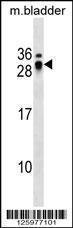 Anti-ECSCR Rabbit Polyclonal Antibody (HRP (Horseradish Peroxidase))