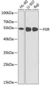 Anti-FGR antibody