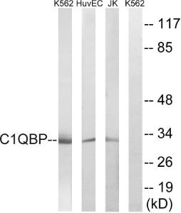 Western blot analysis of lysates from Jurkat, HUVEC, and K562 cells using Anti-C1QBP Antibody. The right hand lane represents a negative control, where the antibody is blocked by the immunising peptide