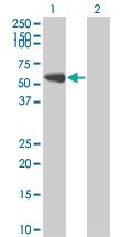 Anti-FYN Mouse Monoclonal Antibody [clone: 3G11-F9]