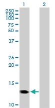 Anti-CMTM1 Mouse Polyclonal Antibody