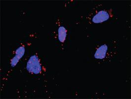 Anti-FGF1 + FGFR4 Antibody Pair