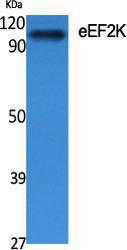 Western blot analysis of various cells using Anti-eEF2K Antibody