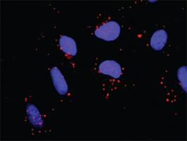 Anti-FYN Mouse Monoclonal Antibody [clone: 3G11-F9]