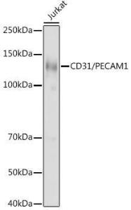 Anti-CD31 antibody