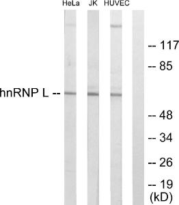 Western blot analysis of lysates from HeLa, Jurkat, and HUVEC cells using Anti-hnRNP L Antibody The right hand lane represents a negative control, where the antibody is blocked by the immunising peptide