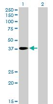 Anti-PNMA1 Rabbit Polyclonal Antibody