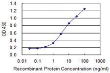 Anti-SERTAD1 Mouse Monoclonal Antibody [clone: 3H4]