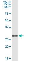 Anti-VEGFB Mouse Monoclonal Antibody [clone: 4H5]