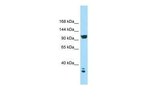 Anti-CACNA2D2 Rabbit Polyclonal Antibody