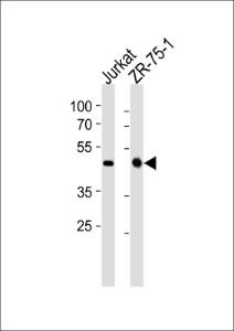 Anti-ECSIT Rabbit Polyclonal Antibody (AP (Alkaline Phosphatase))