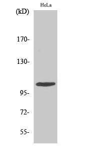 Western blot analysis of HeLa cells using Anti-eEF2K Antibody