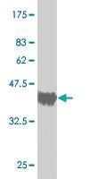 Anti-MED16 Mouse Monoclonal Antibody [clone: 2B7]