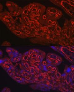 Anti-CD31 antibody