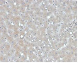 Anti-Apolipoprotein B Mouse Monoclonal Antibody [clone: APOB/4335]