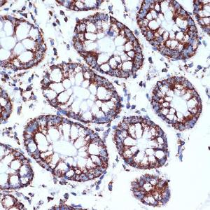 Immunohistochemistry analysis of paraffin-embedded human colon tissue using Anti-CLPP Antibody [ARC1929] (A306224) at a dilution of 1:100 (40x lens). Perform microwave antigen retrieval with 10 mM Tris/EDTA buffer pH 9.0 before commencing with IHC staining protocol.