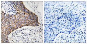 Immunohistochemical analysis of paraffin-embedded human tonsil tissue using Anti-C1QBP Antibody. The right hand panel represents a negative control, where the antibody was pre-incubated with the immunising peptide