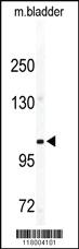 Anti-ITGA5 Rabbit Polyclonal Antibody