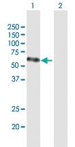 Anti-VEGFC Mouse Polyclonal Antibody