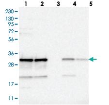 Anti-CCDC43 Rabbit Polyclonal Antibody