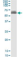 Anti-KLHDC4 Polyclonal Antibody Pair