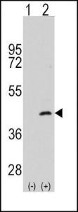 Anti-MAP2K4 Rabbit Polyclonal Antibody (HRP (Horseradish Peroxidase))