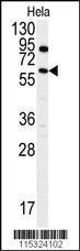 Anti-ANTXR1 Rabbit Polyclonal Antibody (APC (Allophycocyanin))