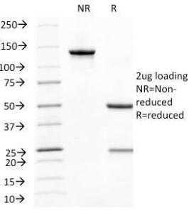 SDS-PAGE analysis of Anti-CD31 Antibody [C31.10] under non-reduced and reduced conditions; showing intact IgG and intact heavy and light chains, respectively. SDS-PAGE analysis confirms the integrity and purity of the Antibody