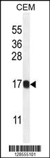 Anti-HIST1H2BJ Rabbit Polyclonal Antibody