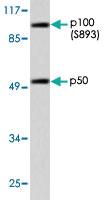 Anti-NFKB1 Rabbit Polyclonal Antibody