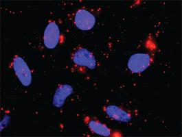 Anti-HSPA1L + MAP3K1 Antibody Pair