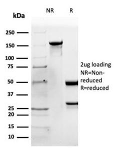 Anti-Apolipoprotein B Mouse Monoclonal Antibody [clone: APOB/4335]