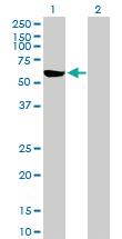 Anti-G6PD Rabbit Polyclonal Antibody