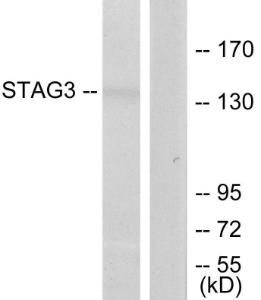 Western blot analysis of lysates from Jurkat cells using Anti-STAG3 Antibody. The right hand lane represents a negative control, where the antibody is blocked by the immunising peptide.