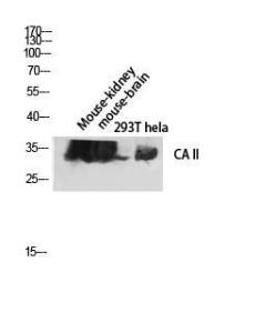 Western blot analysis of mouse kidney mouse brain 293T hela lysis using Anti-CA II Antibody